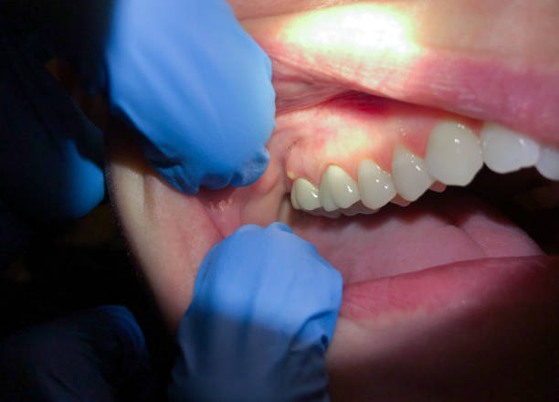 Best Chipped Tooth Repair Near Me  in Dandridge, TN