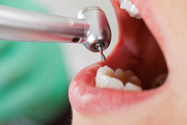 Urgent Tooth Repair in TN